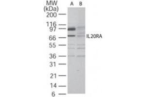 Western blot analysis of IL20RA in A-375 cell lysate in the (A) absence and (B) presence of blocking peptide using IL20RA polyclonal antibody  at 2 ug/mL . (IL20RA 抗体  (AA 159-175))