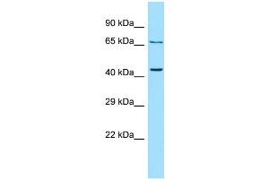 WB Suggested Anti-PTH2R Antibody Titration: 1. (PTH2R 抗体  (C-Term))