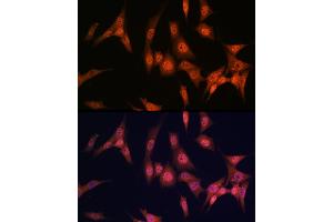 Immunofluorescence analysis of NIH/3T3 cells using P antibody (ABIN7269146) at dilution of 1:100.