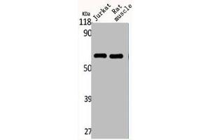 Western Blot analysis of Jurkat RAT-MUSCLE cells using CYP4Z1/2 Polyclonal Antibody (CYP4Z2P 抗体  (Internal Region))
