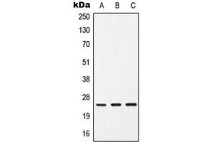 Western blot analysis of CD9 expression in HepG2 (A), SP2/0 (B), H9C2 (C) whole cell lysates. (CD9 抗体  (Center))