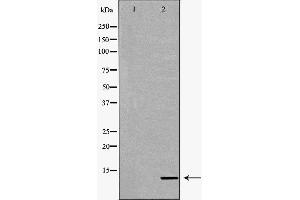 Western blot analysis of extracts of mouse kidney, using CYCS antibody. (Cytochrome C 抗体  (N-Term))