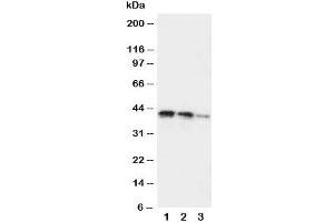 Western blot testing of DDR2 antibody and Lane 1:  recombinant human protein 10ng;  2: 5ng;  3: 2. (DDR2 抗体  (C-Term))
