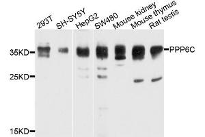 Western blot analysis of extracts of various cells, using PPP6C antibody. (PPP6C 抗体)