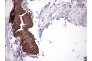 Immunohistochemistry (IHC) image for anti-Amelotin (AMTN) antibody (ABIN2716038) (Amelotin 抗体)