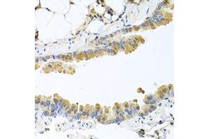 Immunohistochemistry of paraffin-embedded mouse lung using CPA1 antibody. (CPA1 抗体)
