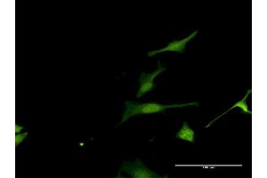 Immunofluorescence of purified MaxPab antibody to FAM117A on HeLa cell. (FAM117A 抗体  (AA 1-453))