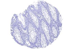 Colon descendes mucosa UPK1b immunostaining is absent in all cells of the colon mucosa (Uroplakin 1B 抗体  (AA 109-229))