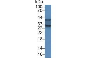 Detection of SOD3 in Rat Kidney lysate using Polyclonal Antibody to Superoxide Dismutase 3, Extracellular (SOD3) (SOD3 抗体  (AA 16-244))