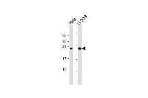 All lanes : Anti-DCTN6 Antibody (Center) at 1:1000 dilution Lane 1: Hela whole cell lysate Lane 2: U-2OS whole cell lysate Lysates/proteins at 20 μg per lane. (DCTN6 抗体  (AA 53-80))