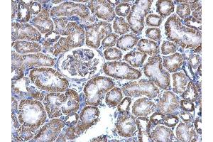 Immunohistochemistry (IHC) image for anti-Nicotinamide Nucleotide Transhydrogenase (NNT) (C-Term) antibody (ABIN2855538)
