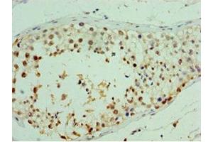 Immunohistochemistry of paraffin-embedded human testis tissue using ABIN7167040 at dilution of 1:100 (RDM1 抗体  (AA 125-284))