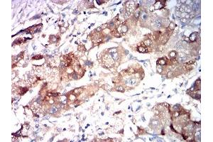 Immunohistochemistry (IHC) image for anti-Asialoglycoprotein Receptor 2 (ASGR2) (AA 80-311) antibody (ABIN7193549)