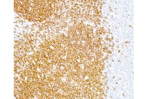 Immunohistochemistry (IHC) image for anti-Membrane-Spanning 4-Domains, Subfamily A, Member 1 (MS4A1) antibody (ABIN7449560)