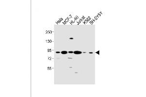 All lanes : Anti-CCNT1 Antibody (Center) at 1:1000 dilution Lane 1: Hela whole cell lysate Lane 2: MCF-7 whole cell lysate Lane 3: HL-60 whole cell lysate Lane 4: Jurkat whole cell lysate Lane 5: K562 whole cell lysate Lane 6: SH-SY5Y whole cell lysate Lysates/proteins at 20 μg per lane. (Cyclin T1 抗体  (AA 253-281))