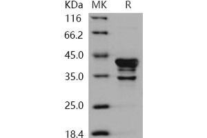 Western Blotting (WB) image for Calcium/calmodulin-Dependent Protein Kinase I (CAMK1) protein (ABIN7317143) (CAMK1 蛋白)