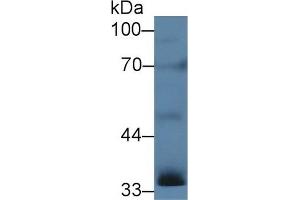 Detection of INHa in Rat Testis lysate using Polyclonal Antibody to Inhibin Alpha (INHa) (Inhibin alpha 抗体  (AA 25-363))