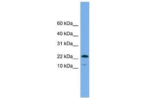 WB Suggested Anti-WFDC1 Antibody Titration: 0. (WFDC1 抗体  (N-Term))