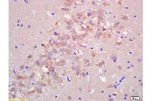 Formalin-fixed and paraffin embedded rat brain labeled with Rabbit Anti FIS1/TTC11 Polyclonal Antibody, Unconjugated (ABIN872461) at 1:200 followed by conjugation to the secondary antibody and DAB staining (Fission 1 抗体  (AA 55-152))