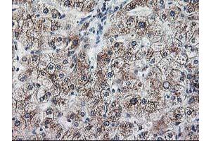Immunohistochemistry (IHC) image for anti-Ribophorin 1 (RPN1) antibody (ABIN1500748) (RPN1 抗体)