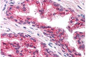 Human Prostate (formalin-fixed, paraffin-embedded) stained with FOXA1 antibody ABIN214751 at 5 ug/ml followed by biotinylated goat anti-rabbit IgG secondary antibody ABIN481713, alkaline phosphatase-streptavidin and chromogen. (FOXA1 抗体  (AA 395-444))