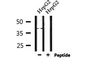 Western blot analysis of extracts from HepG2, using NEIL2 Antibody. (NEIL2 抗体  (Internal Region))
