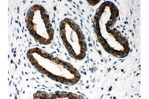 Immunohistochemistry (IHC) image for anti-Peroxiredoxin 1 (PRDX1) (AA 100-128), (Middle Region) antibody (ABIN3043903)