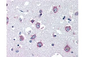 Anti-NPC1 antibody IHC of human brain, cortex. (NPC1 抗体)