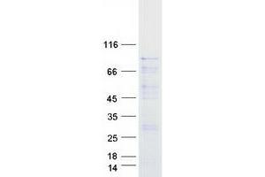 Western Blotting (WB) image for V-Raf-1 Murine Leukemia Viral Oncogene Homolog 1 (RAF1) protein (Myc-DYKDDDDK Tag) (ABIN2730424)