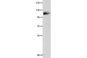 Western blot analysis of Mouse lung tissue, using AMPH Polyclonal Antibody at dilution of 1:500 (Amphiphysin 抗体)