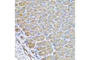 Immunohistochemistry of paraffin-embedded mouse stomach using VPS37A antibody at dilution of 1:100 (x40 lens). (VPS37A 抗体)