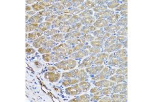 Immunohistochemistry of paraffin-embedded mouse stomach using VPS37A antibody at dilution of 1:100 (x40 lens). (VPS37A 抗体)