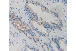 Used in DAB staining on fromalin fixed paraffin- embedded Kidney tissue (GRK6 抗体  (AA 186-448))