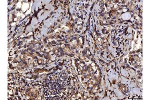IHC analysis of PDIA6 using anti-PDIA6 antibody (ABIN7600554). (PDIA6 抗体  (AA 20-440))