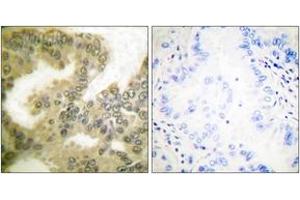 Immunohistochemistry (IHC) image for anti-Cyclin D3 (CCND3) (AA 243-292), (pSer283) antibody (ABIN1531266)
