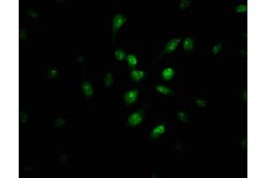 Immunofluorescence staining of U251 cells with ABIN7163461 at 1:100, counter-stained with DAPI. (Pirin 抗体  (AA 1-290))