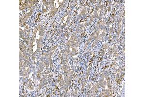 IHC analysis of SND1 using anti-SND1 antibody (ABIN7600526). (SND1 抗体  (AA 20-204))