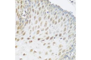Immunohistochemistry of paraffin-embedded human esophagus using SNAI1 antibody (ABIN5975364) at dilution of 1/100 (40x lens).