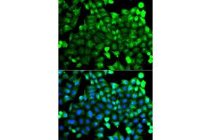 Immunofluorescence analysis of A549 cells using NCALD antibody. (NCALD 抗体)