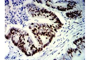 Immunohistochemistry (IHC) image for anti-Antigen Identified By Monoclonal Antibody Ki-67 (MKI67) (AA 1160-1493) antibody (ABIN7193709)