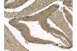 ST13 Mouse Monoclonal Antibody at 1/100 staining rat colorectal tissue by IHC-P. (HSC70 Interacting Protein HIP 抗体)