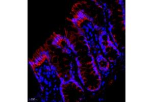 Immunofluorescent analysis of paraffin embedded rat colon using PMCA1 (ABIN7073155) at dilution of 1: 500 (ATP2B1 抗体)