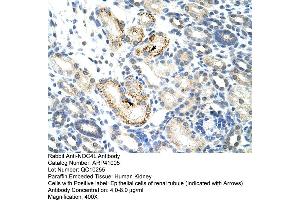 Rabbit Anti-NOC4L Antibody  Paraffin Embedded Tissue: Human Kidney Cellular Data: Epithelial cells of renal tubule Antibody Concentration: 4. (NOC4L 抗体  (C-Term))