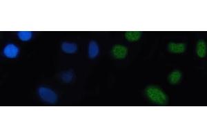 IF analysis of Nkx2.