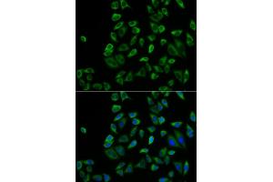 Immunofluorescence (IF) image for anti-Peroxisomal Biogenesis Factor 5 (PEX5) (AA 1-260) antibody (ABIN6145469)