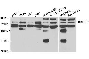 Western blot analysis of extracts of various cell lines, using KBTBD7 antibody (ABIN5975133) at 1/1000 dilution. (KBTBD7 抗体)