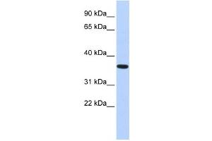 Western Blotting (WB) image for anti-CPX Chromosome Region, Candidate 1 (CPXCR1) antibody (ABIN2458436) (CPXCR1 抗体)