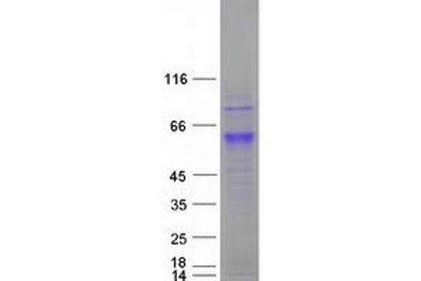 CCT6A Protein (Transcript Variant 2) (Myc-DYKDDDDK Tag)