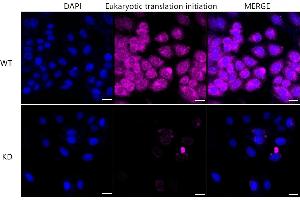 anti-Eukaryotic Translation Initiation Factor 2A, 65kDa (EIF2A) antibody
