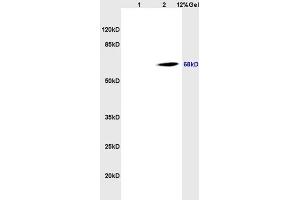 Lane 1: rat brain lysates Lane 2: human colon carcinoma lysates probed with Anti CD98 Polyclonal Antibody, Unconjugated (ABIN719546) at 1:200 in 4 °C.